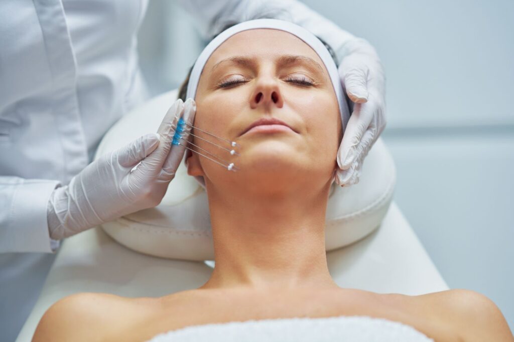 Une femme allongé les yeux fermés avec des aiguilles dans le menton pour illustrer l'article sperme de saumon en injection.