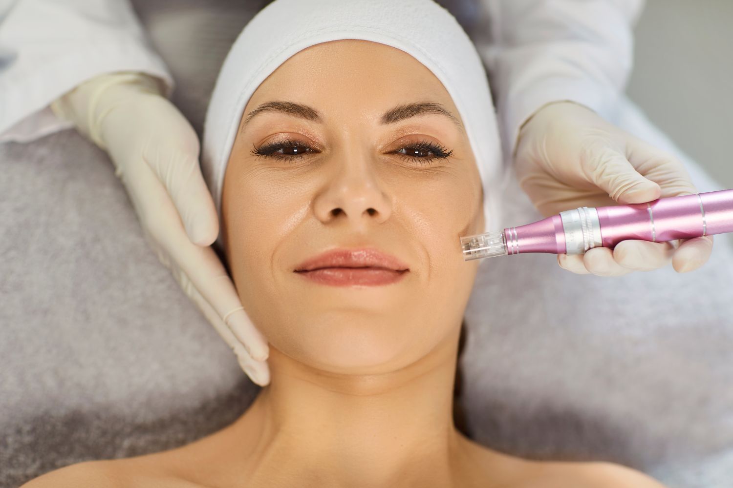 Une femme allongée sur une serviette grise recoit un injection dans le visage par des mains gantée de gants chirurgicaux pour illustrer l'article sperme de saumon en injection.